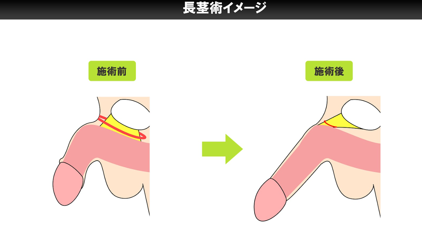 Amazon.co.jp: 何歳からでも始められるペニストレーニング (SANWA MOOK)