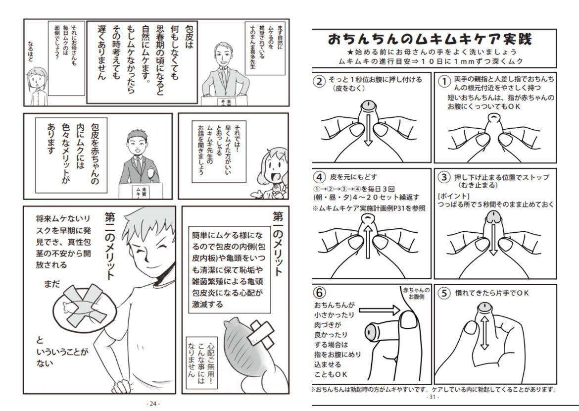 マイピース コックリング 仮性 包茎矯正