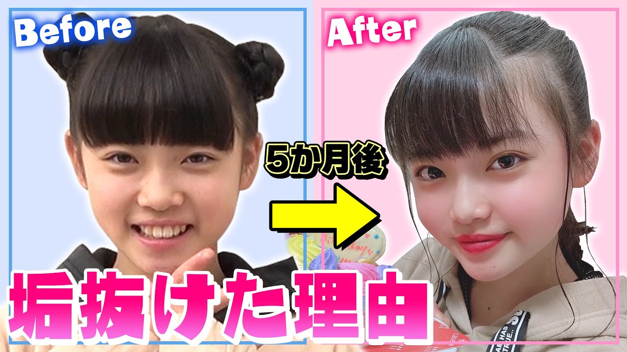 こども 前髪薄くTikTok