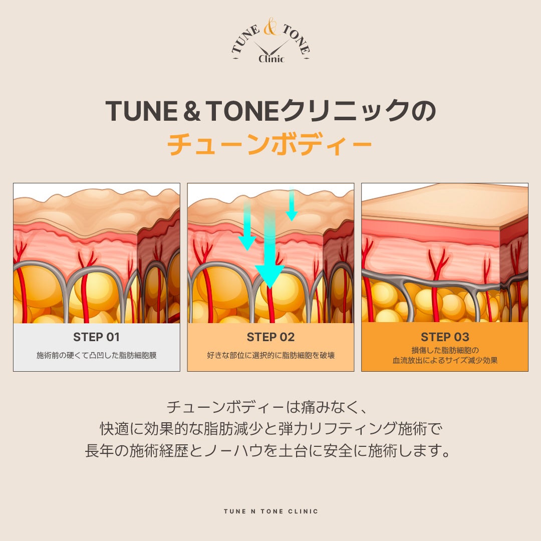 ビューチューン・ボディ | 化粧品製造・販売・企画の株式会社cosbi