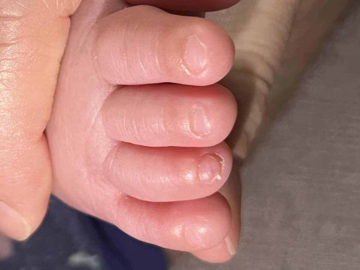 赤ちゃんの足裏から読み取る体温サイン