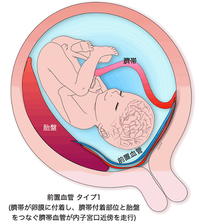 赤ちゃんのへその緒を大事に保管！人気の臍帯箱・へその緒ケース3選ベビーカレンダ