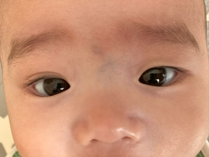 赤ちゃんの一重まぶたは成長過程でいつから二重になるのか？親からの遺伝の確率は？パパマックス