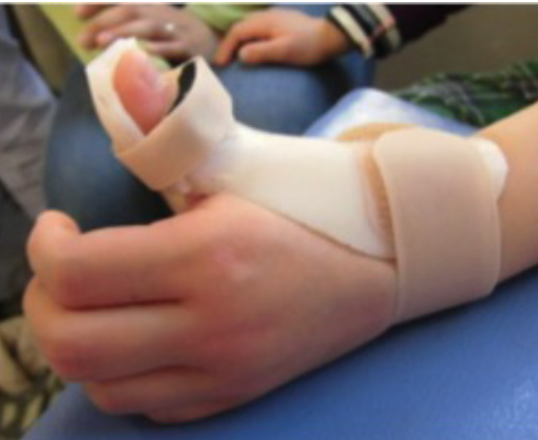 国際基準に基づく小奇形アトラス - 日本小児遺伝学会