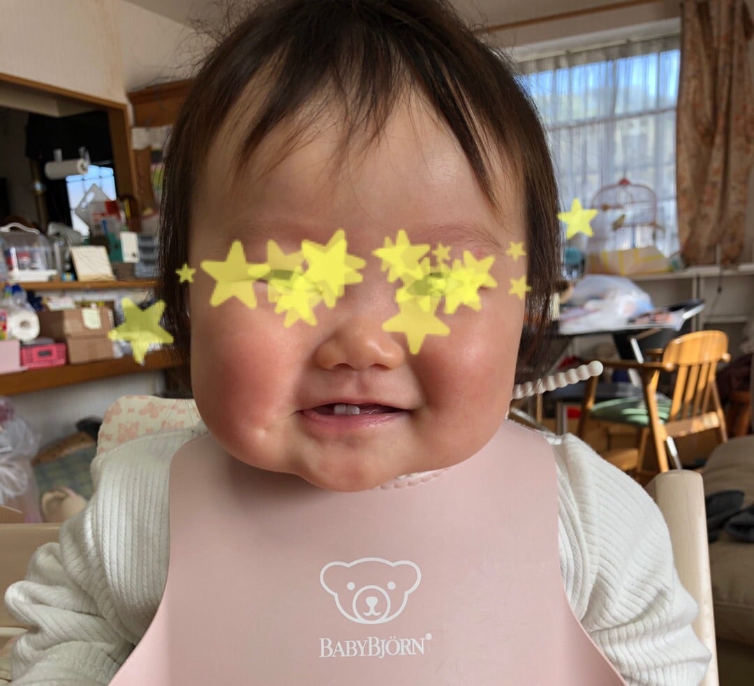 放置するだけでえくぼが出来る器具実際に試してみた！ 美容コスメえくぼ垢抜け