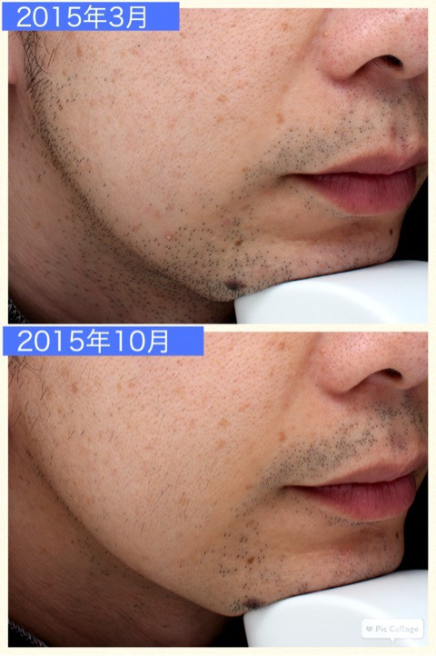 私なら絶対くっつきたくないジョリジョリの髭を 愛おしそうになめまくるかーくん子供の無償の愛やばいSHOEIさんご褒美だと思ってもっと喜んで☝️😐笑 今日のYouTubeはなんと ！ SHOEIさんが禁断のあいつを作りたいと言って自宅を改造してしまったお話です 涙 みんな