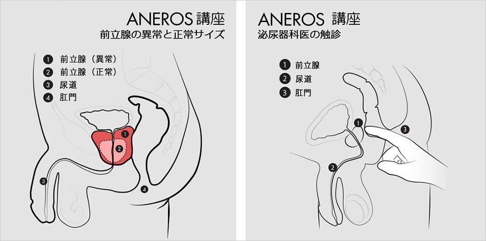 前立腺責めのやり方とコツ！気持ちいい前立腺マッサージの方法をイラストで解説