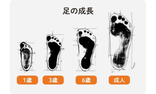 子どもの足に異変アリ！？外反扁平足とは医療・健康コラムファミリードクタ
