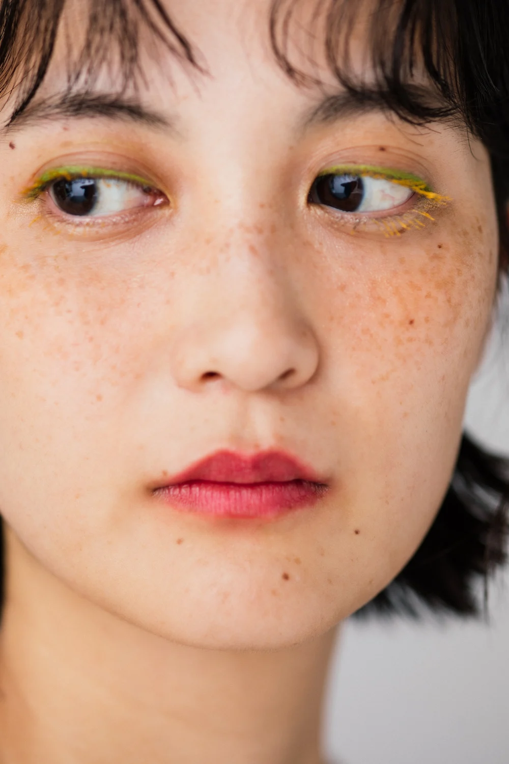 そばかすを消す方法10選！自力での方法やクリニックでの治療法を解説東京上野御徒町のエールクリニック