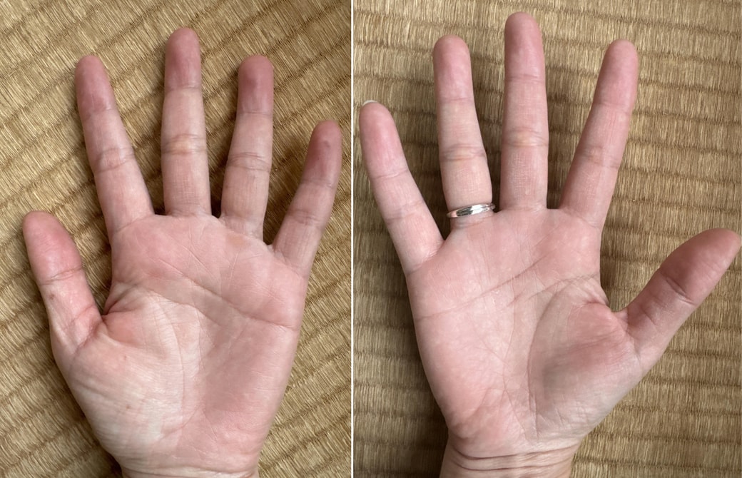 手相のファミリーリングの意味！右手左手・子宝・性別Spicomi