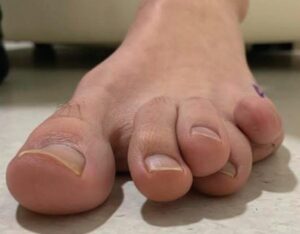 赤ちゃんの足指トレーニング＆ママのスタイルアップとしての「ハイハイ」 - 福岡のみらいクリニック