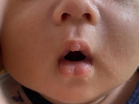 おちょぼ口♡ざわわさんの毎日♪