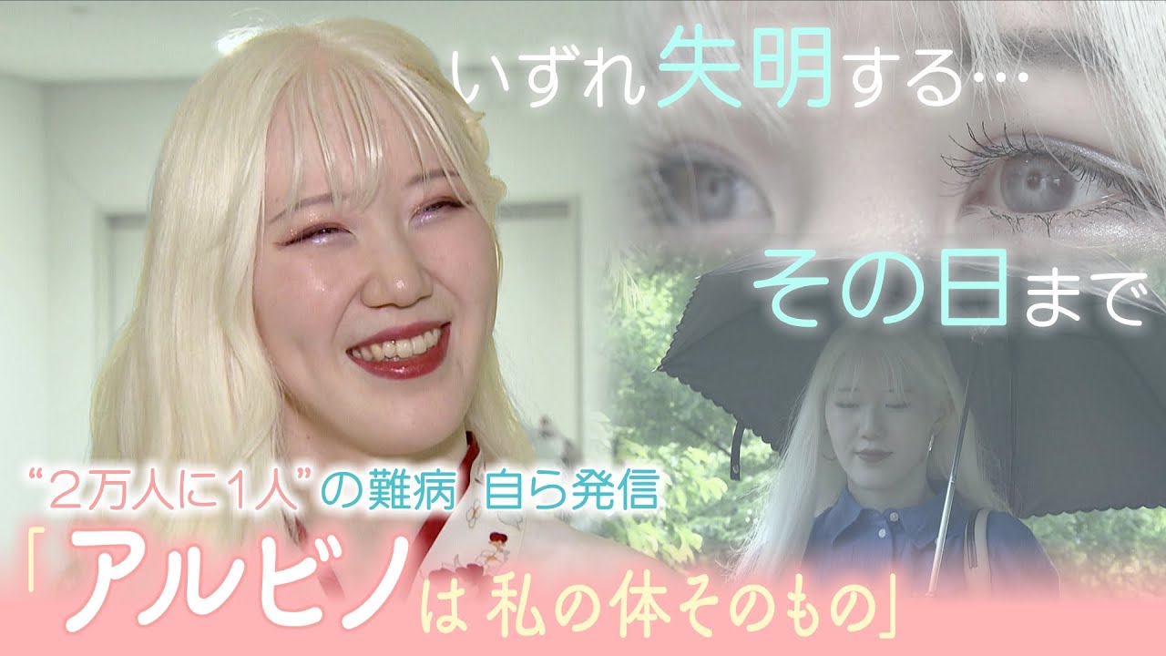 夏の思い出まとめました✌🏻 ̖́-, 今年の夏も沢山楽しめました😊,アルビノalbinismりっくんりっくんの姉ですかっこいい,白髪男子男の子大家族8人きょうだい福岡北九州 ,夏の思い出夏休み夏休みの過ごし方夏たのしかったおうちじかん