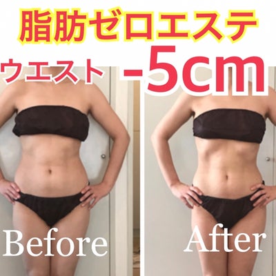 西宮で人気のダイエット徹底比較！ダイエットが安いコスパ最強-No.1のクリニックはここだ！ | 美容医療の情報WEBマガジン「マイクリニック」