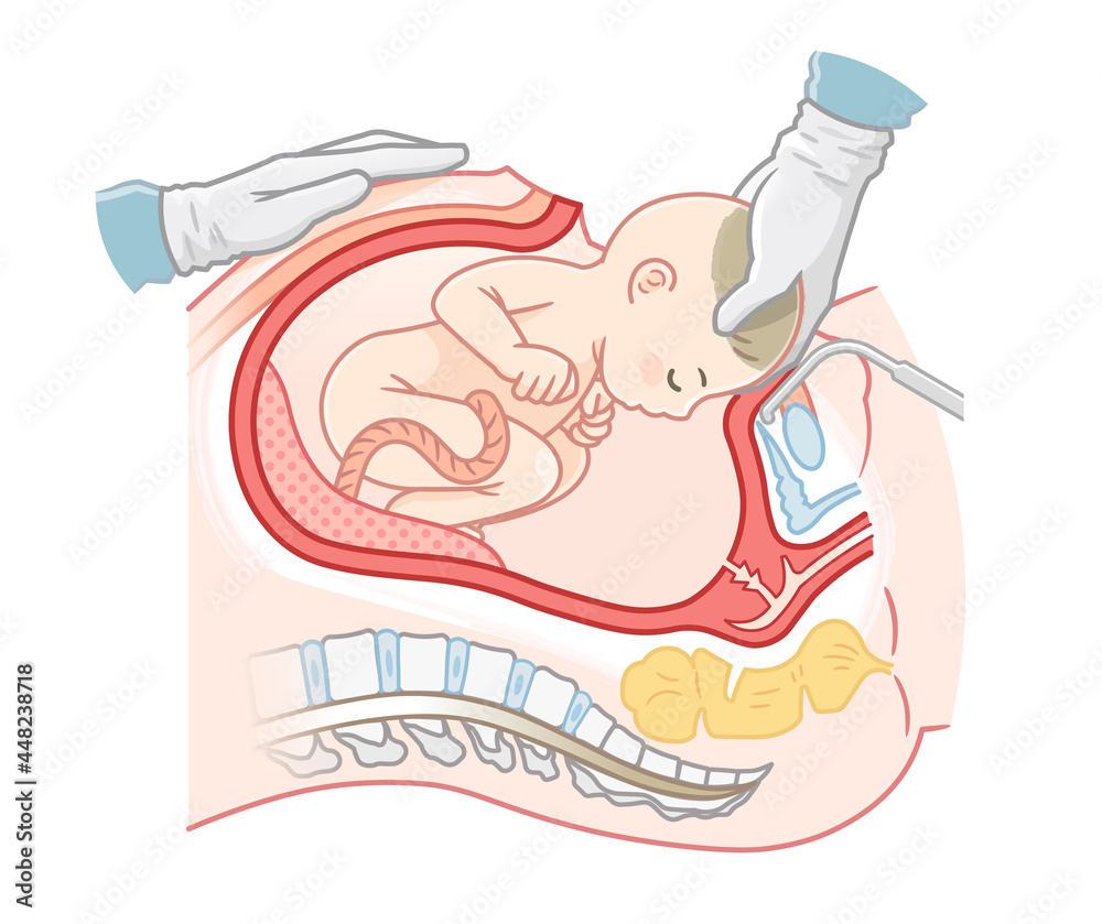 生まれたばかりの赤ちゃんイラスト - No: 1518537無料イラスト・フリー素材なら「イラストAC」