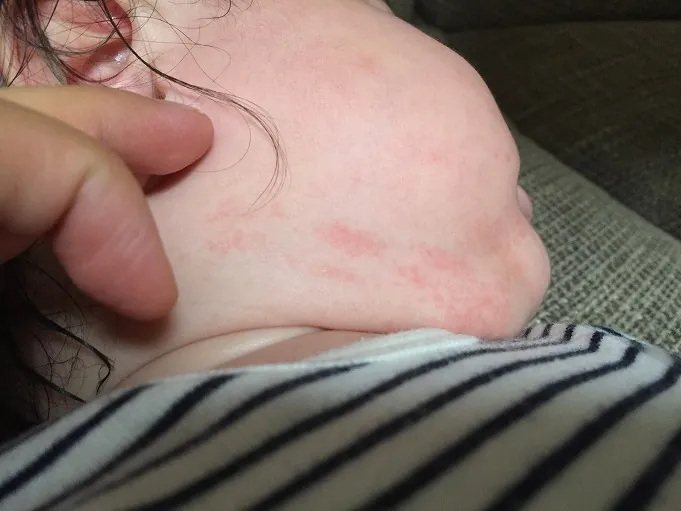 頭をかきむしるイラスト無料イラスト・フリー素材なら「イラストAC」