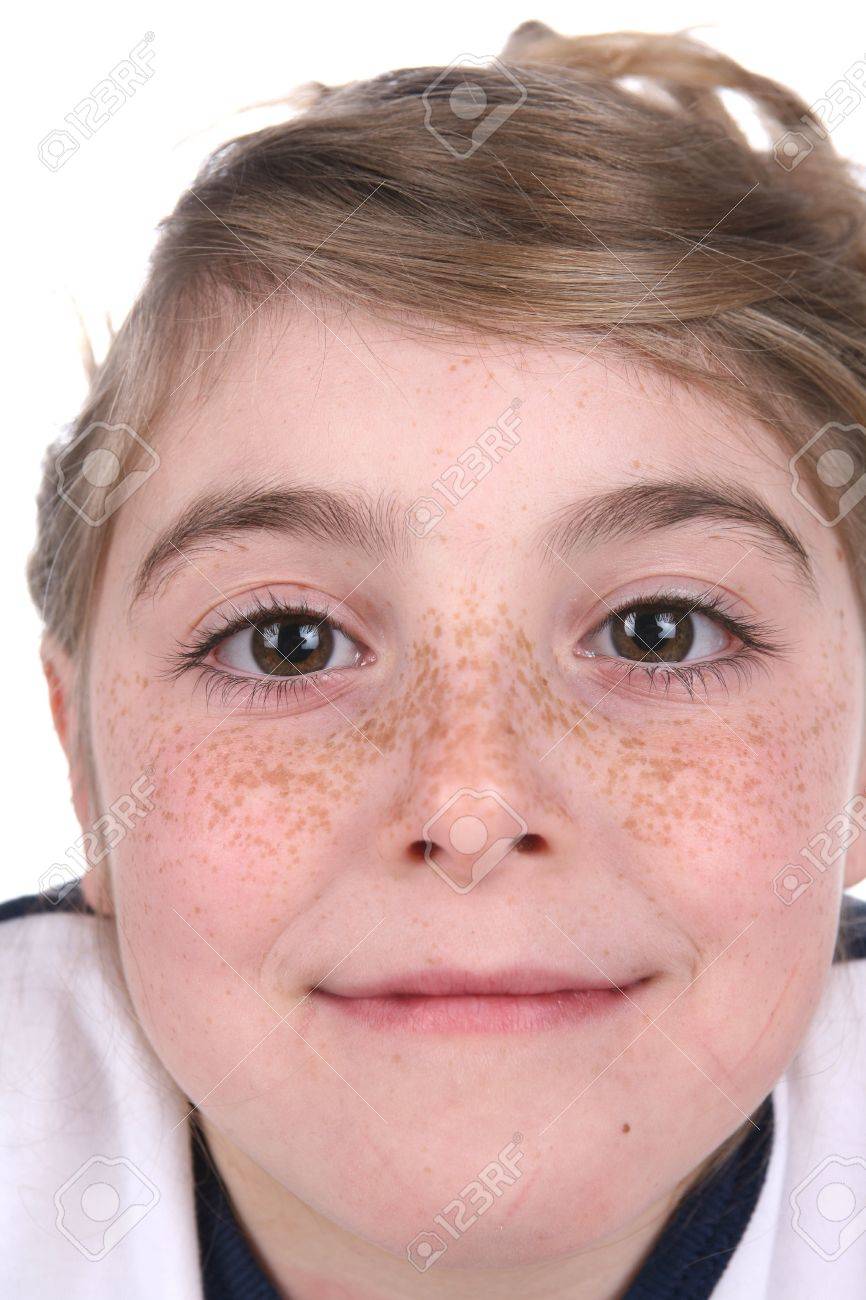 しみそばかすいのう皮フ科形成外科