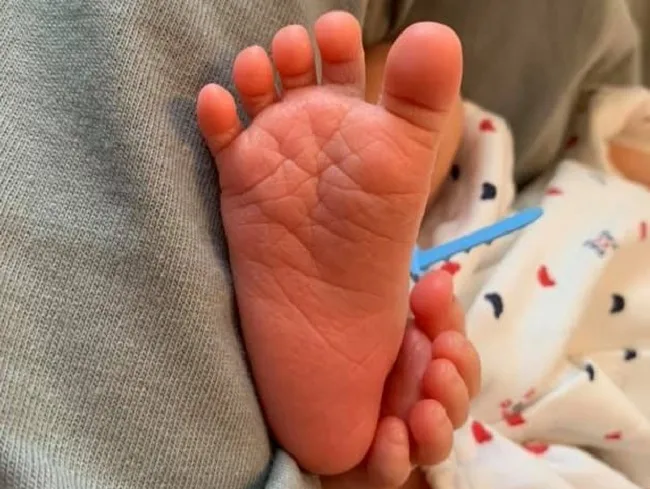 子どもの足指がねじれている？！カーリートゥ 巻き趾 ってどんな足