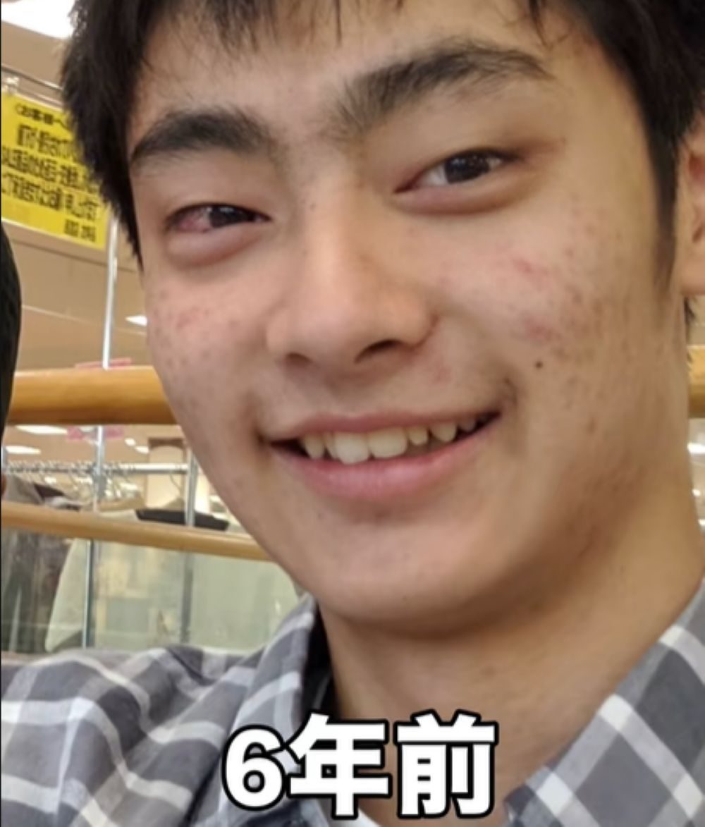 写真8ページ目 ｢お兄ちゃんはかっこいいのにお前は残念だな｣と言われたことも 体重120キロのゲイ男性 35 →“57キロの超イケメン”に変身させた「ある事件」文春オンライン