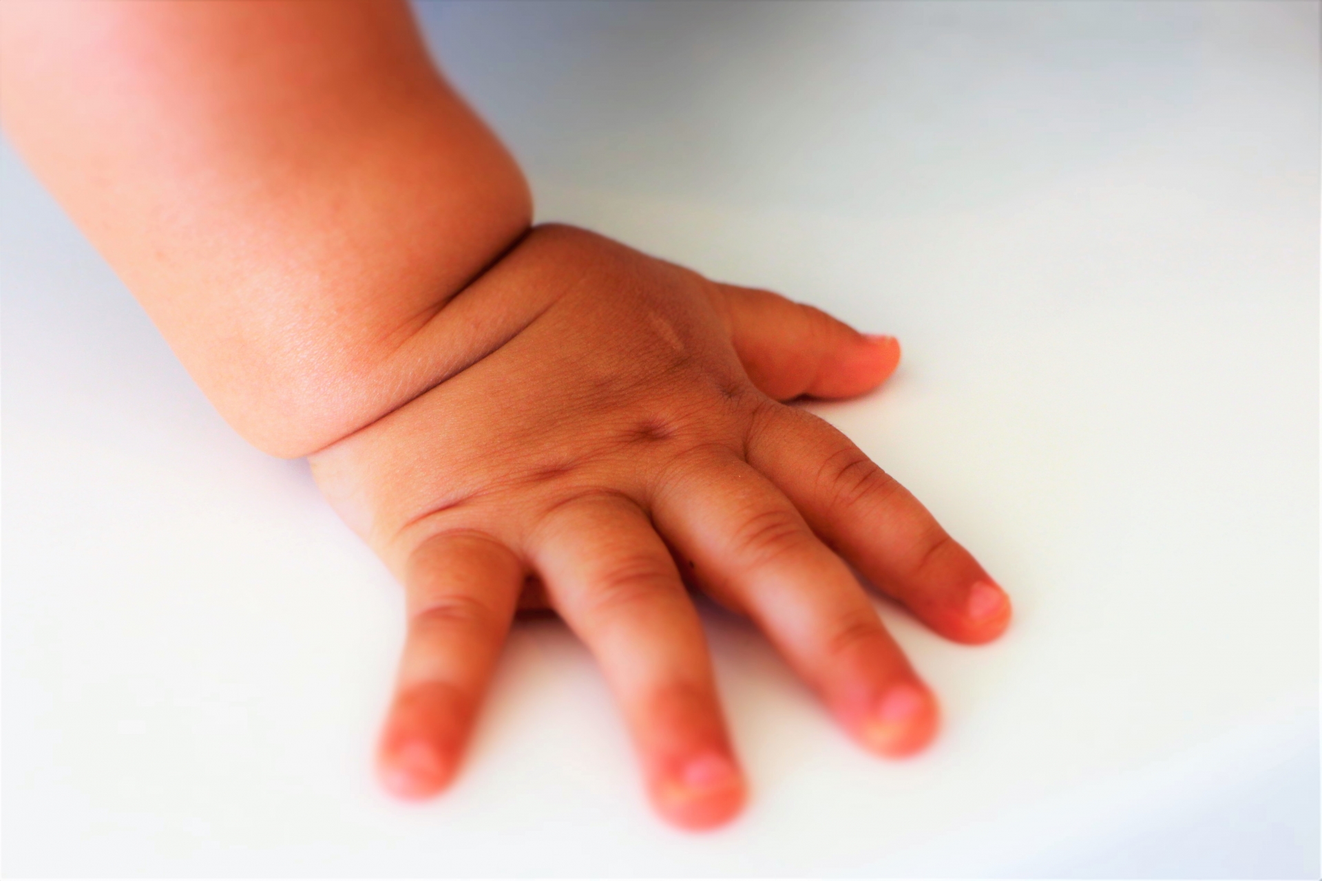 新生児期の赤ちゃんにぶつぶつが！湿疹の種類と対処法をご紹介！ - teniteo テニテオ