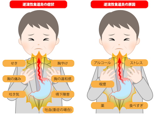 【たった１分】動悸・息苦しさを改善するツボ☆不安症・パニック障害にも効果的 治し方｜大阪府高石市の自律神経専門整体院 natura-ナチュラ-