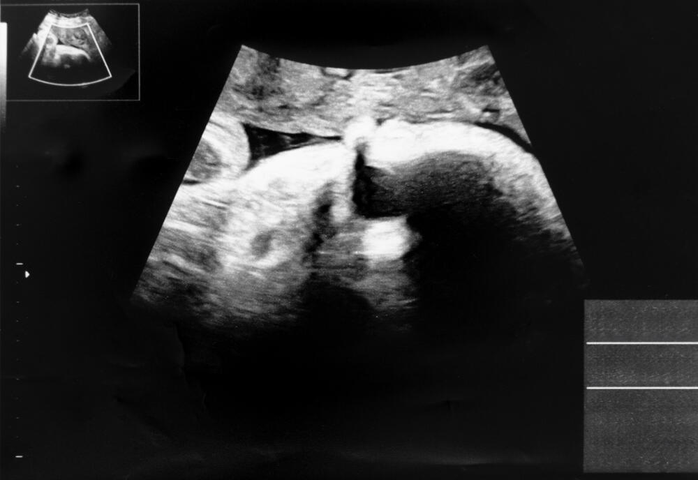 妊娠9か月 32〜35週 のママ・赤ちゃんの様子ややるべきことマタニティケア妊娠・育児のお役立ちコラム無添加せっけんとハーブのアラウ