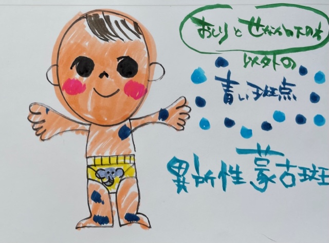 放置しないで！「異所性蒙古斑」 は一生残ることも！ 医師監修 大西皮フ科形成外科医院