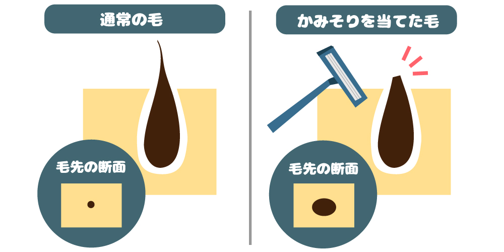 なぜ日本人は究極のムダ毛「陰毛」を処理しないの？アホなの？ | 株式会社LIG(リグ)｜DX支援・システム開発・Web制作