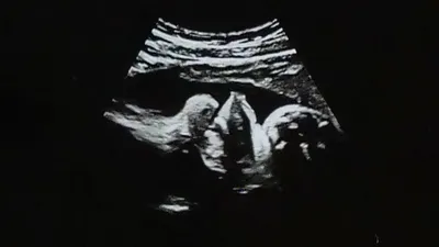 妊娠10ヶ月 いよいよ臨月！赤ちゃんはいつ産まれる？臨月の体験談助産師監修ままのて