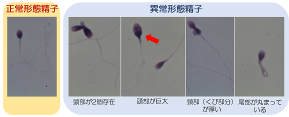 精子を良くするには、何を食べたらいいのか - 医療法人オーク会 不妊ブログ