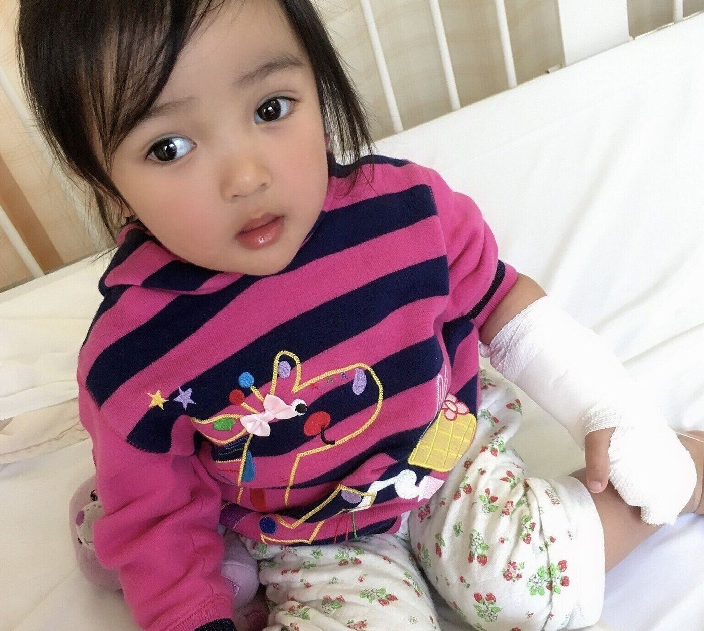 顔のあざのレーザー治療と子供への負担の心配新潟市で形成外科,美容外科,美容皮膚科をお探しならやまもと形成外科