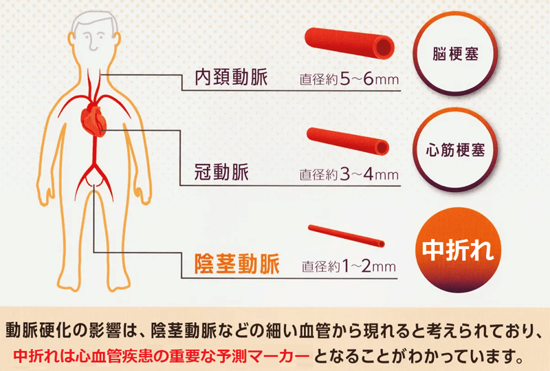 サウナはペニス増大に効果がある！勃起力は血行の良さが大事 | ザヘルプM