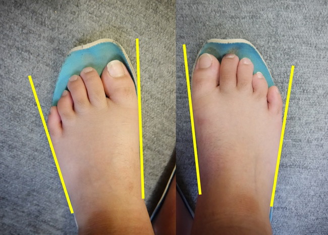 健康のプログラム「足が速くなる方法」＠岐阜県恵那市