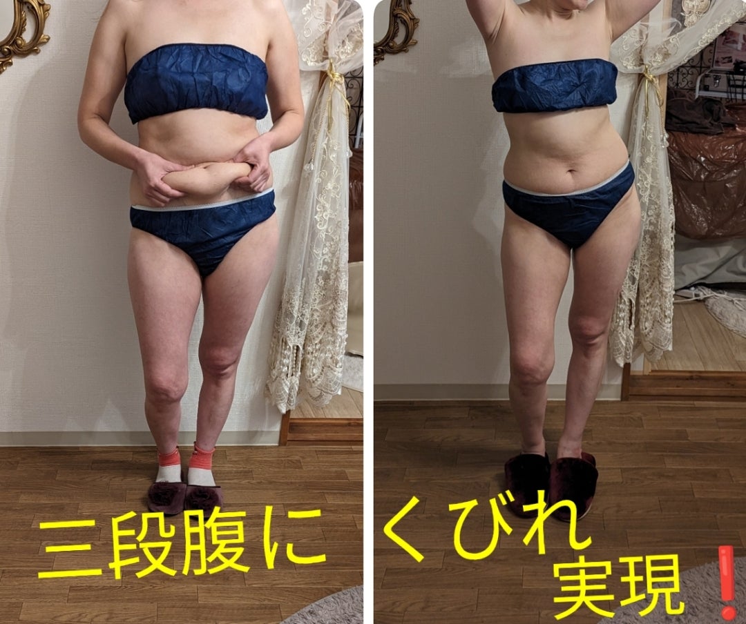 大阪府でダイエットが人気のエステサロン｜ホットペッパービューティー