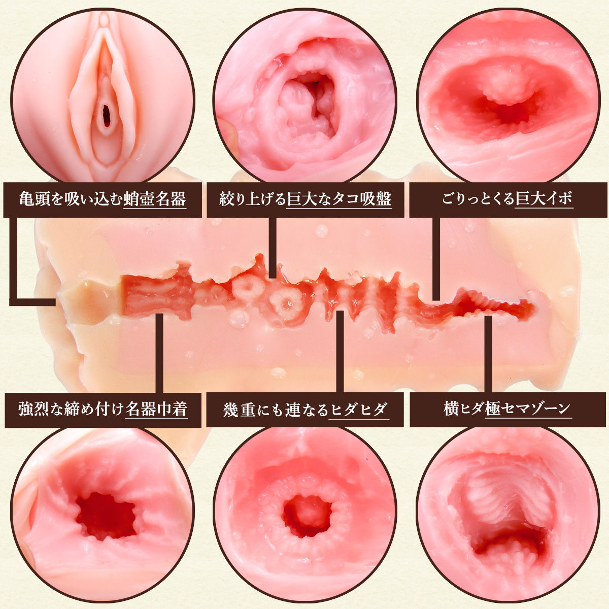 膣ヒアルロン酸１０ｃｃ＋名器形成｜婦人科形成の症例紹介｜銀座の美容外科・皮膚科ならルーチェクリニック