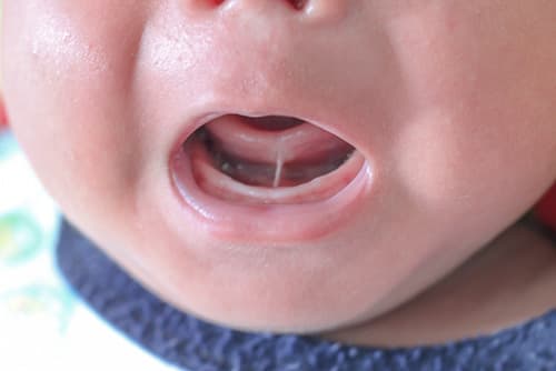 舌を出す女の子 写真素材841016- フォトライブラリ