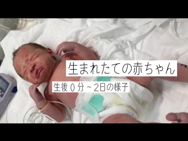 赤ちゃんの城 ツーウェイオール 半袖 日本製 春 夏 男の子 赤ちゃん 新生児 ベビー ベビー服 出産準備 出産祝い 50〜70 星柄ガーゼ :赤ちゃんの城Yahoo!店 - 通販 - Yahoo!ショッピング