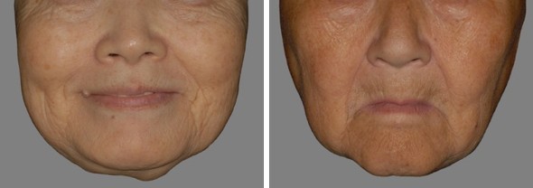 誰からも愛される「幸せな顔」の共通点とは？なるためのコツは？女性の美学