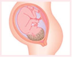 医師監修 妊娠36週臨月の症状やお腹の張り、赤ちゃんの状態や注意点cozre コズレ 子育てマガジン