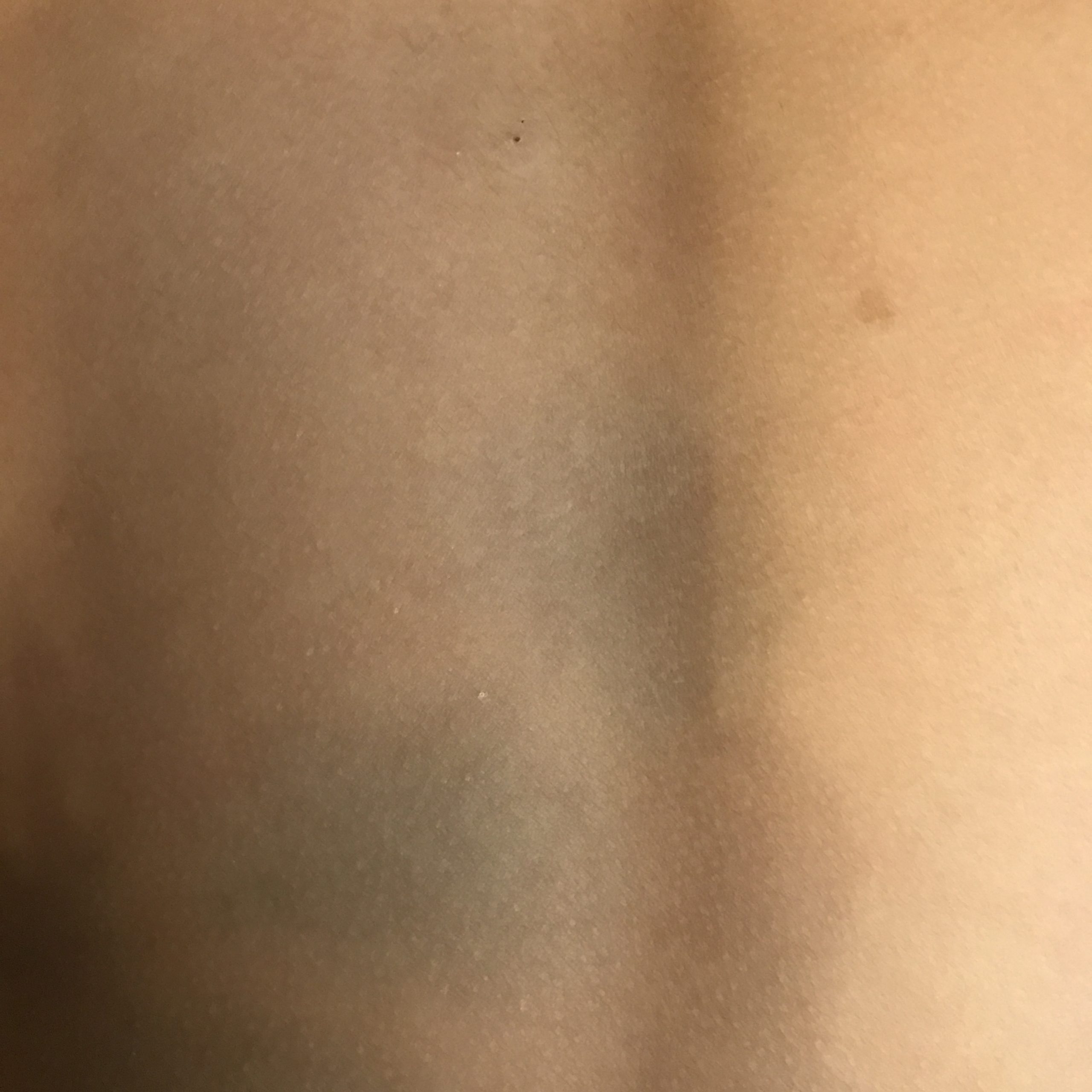 もしかしてこれも蒙古斑？さら助産院「母乳育児とべビマ、そして性教育」Powered by Ameba