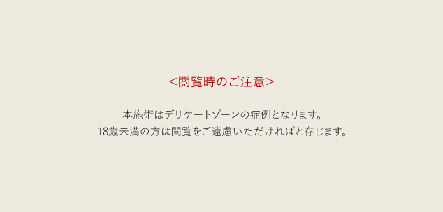 陰核（クリトリス）包茎術｜婦人科形成なら湘南美容クリニック【公式】