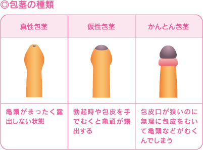 ペニス増大サプリの商品一覧-ココロ薬局