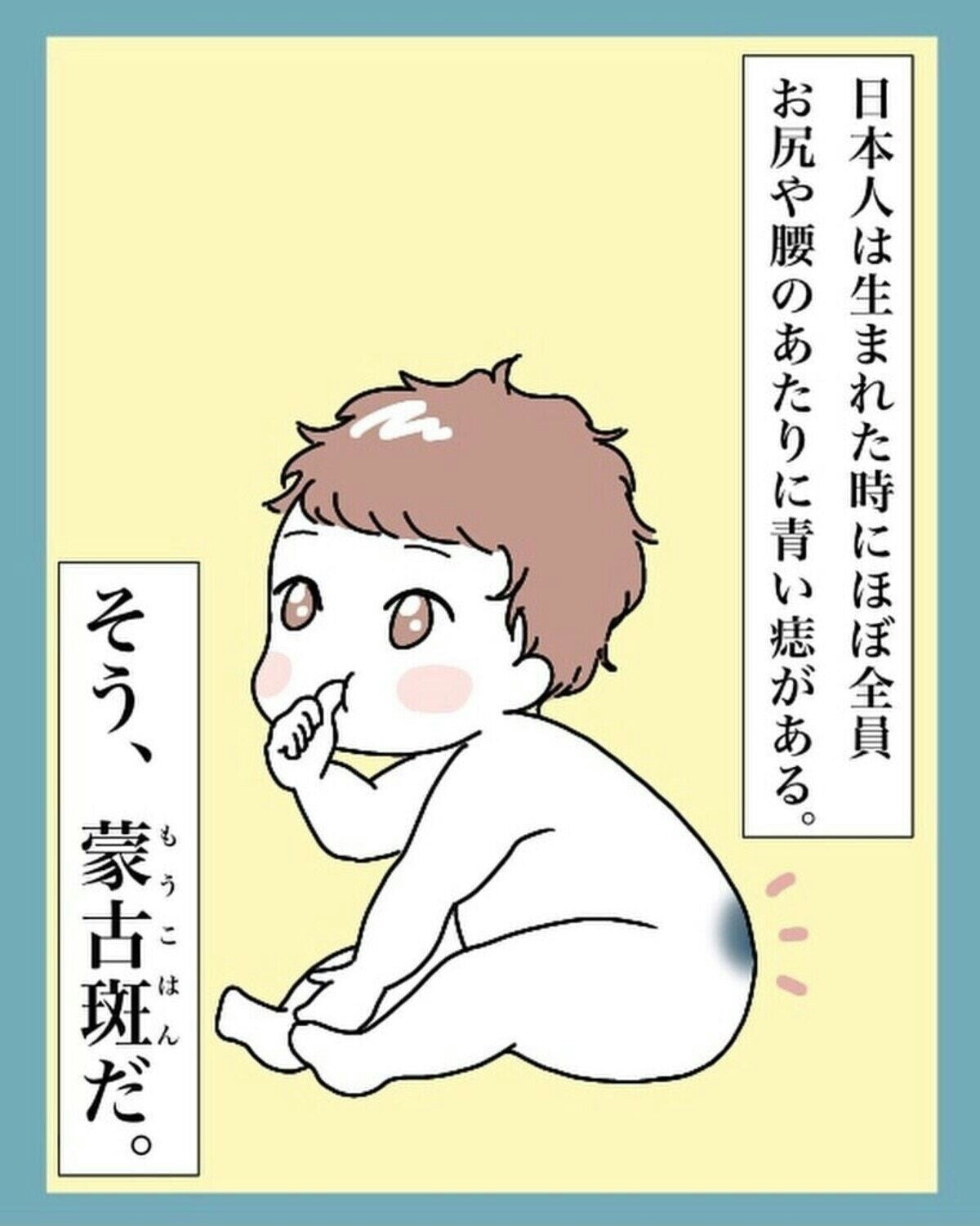 もしかしてこれも蒙古斑？さら助産院「母乳育児とべビマ、そして性教育」Powered by Ameba