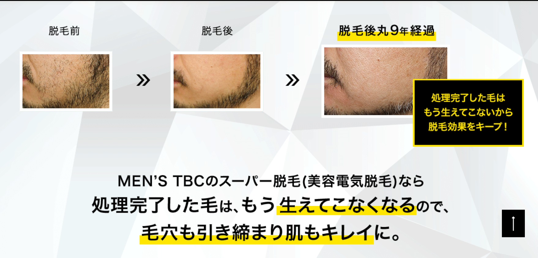 メンズ（MEN'S)TBCのヒゲ脱毛体験コース1,000円で脱毛する様子をサロンで実際見せてもらった＆話を詳しく聞いてきた【画像がりの口コミと評判・実際に見た感想】  - さんぽガーデン（今すぐ知りたい！お役立ち最新情報）