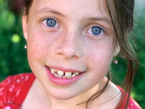 そばかすを消す方法は？セルフケアと対策法・皮膚科のレーザー治療