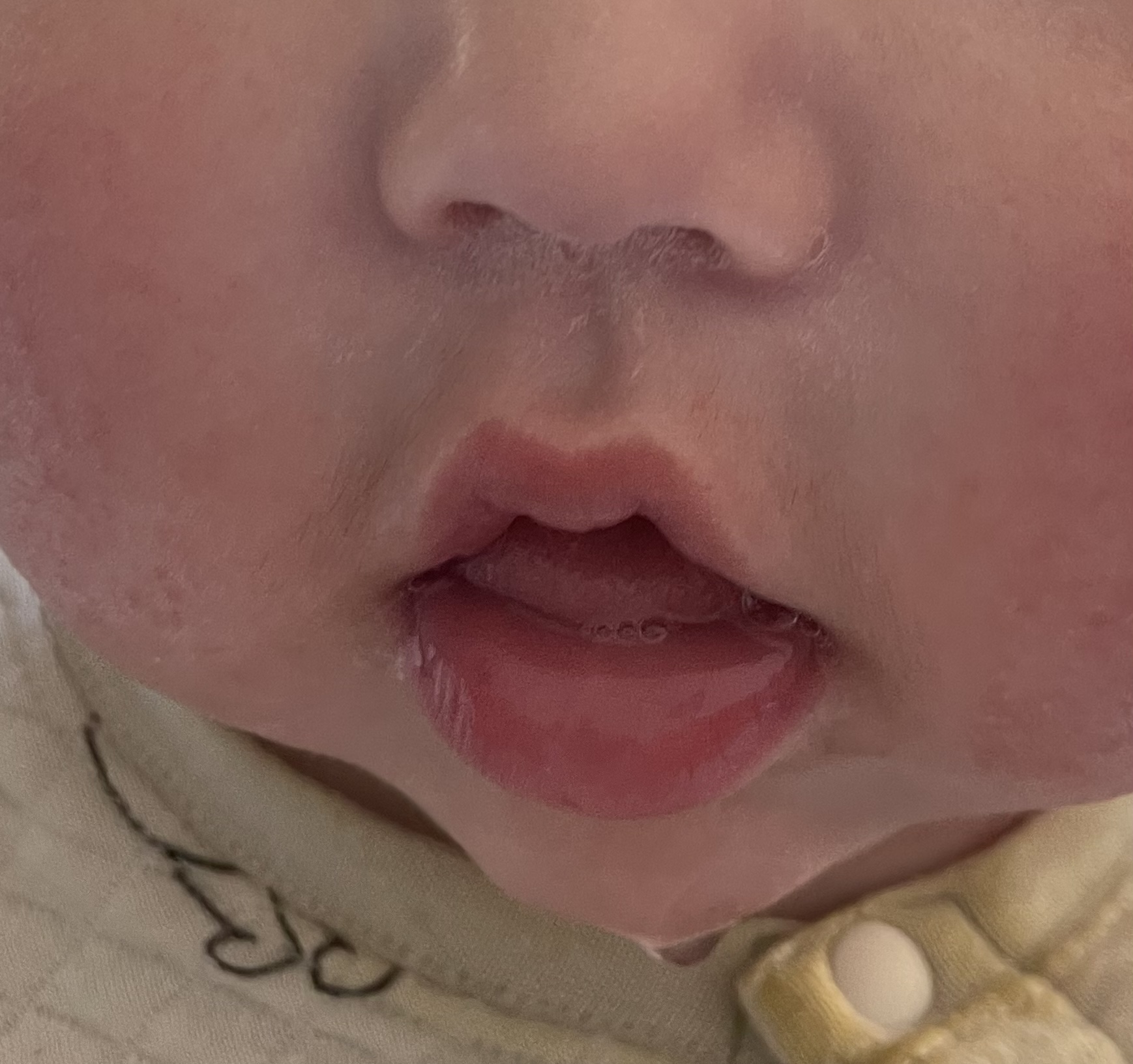 写真あり0歳児。口呼吸なので歯並びが心配です歯チャンネル歯科相談室