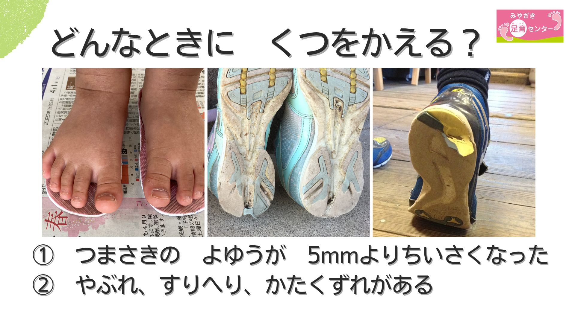 子どもたちの手足を石膏で残すLEE