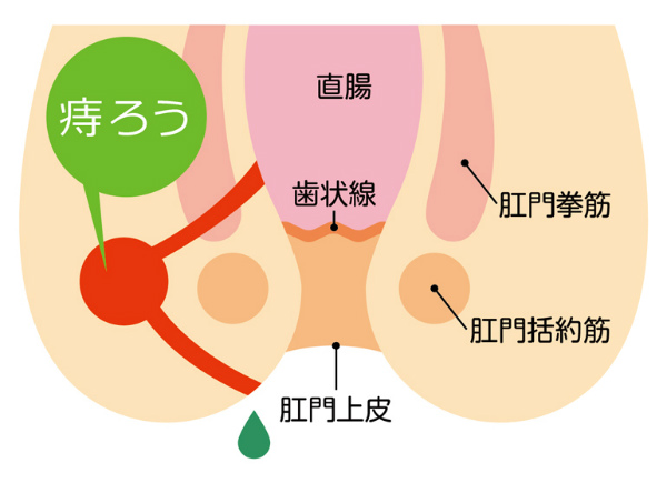 オリジナル】 休み時間にトイレのウォシュレットでアナニーする女の子。 - カシン工房