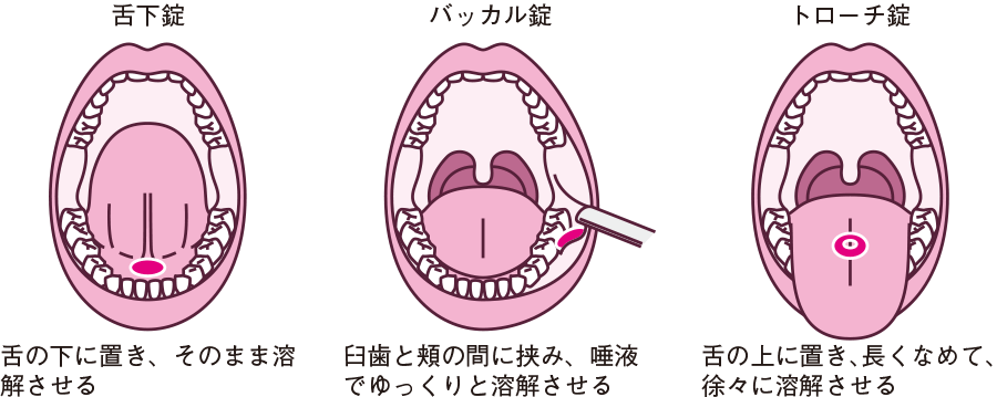 舌小帯短縮症とは？ | 仁愛会歯科｜学芸大学/自由ヶ丘/武蔵小杉/日吉/綱島台/綱島/綱島駅前の歯医者