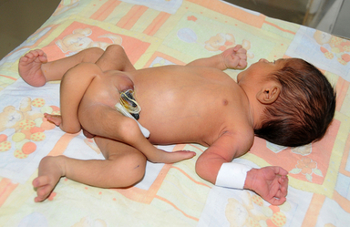 無痛分べん」8割が“賛成”でも――日本では1割弱のみ、広がらないワケ“出産の痛み”は必要？ 意識に変化もみんなのギモン2023年8月30日掲載 日テレNEWS NNN